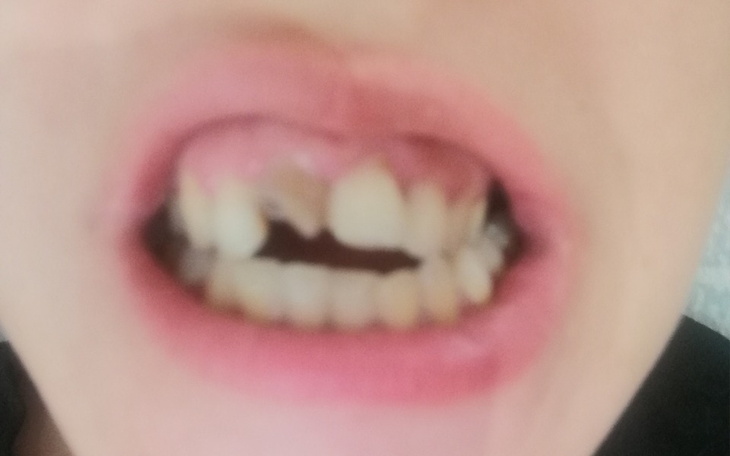 Zbiórka Zbieram na leczenie zębow .. - zdjęcie główne