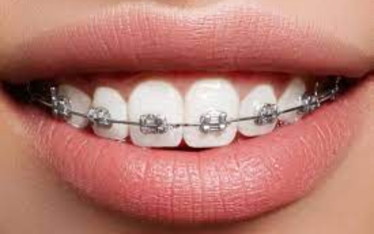 Zbiórka Nowy uśmiech przyjaciółki - zdjęcie główne