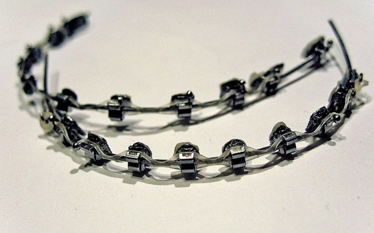 Zbiórka aparat na zęby na stałe - zdjęcie główne