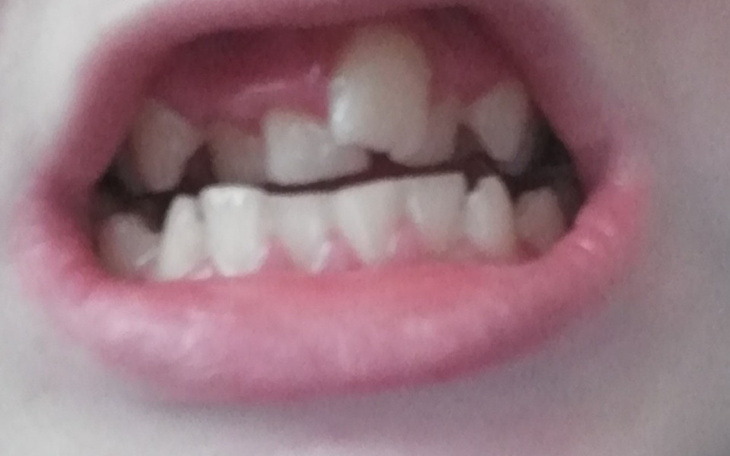 Zbiórka Pomoc na zdrowe zęby - zdjęcie główne