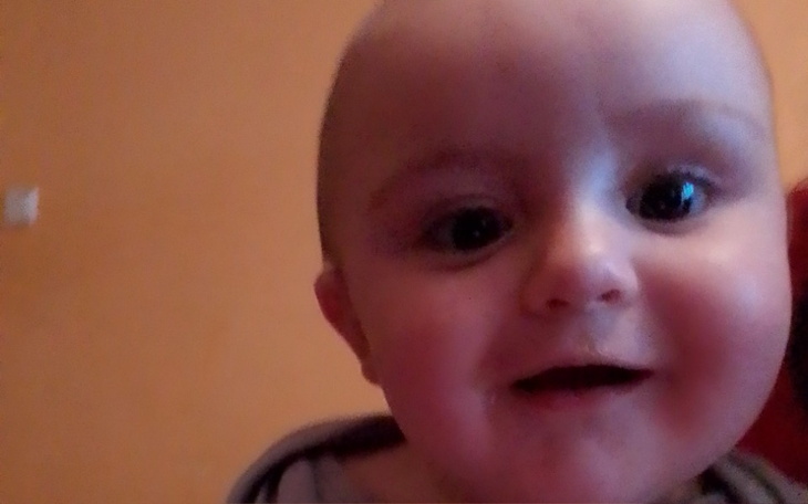 Zbiórka Leczenie plagiocefali - zdjęcie główne