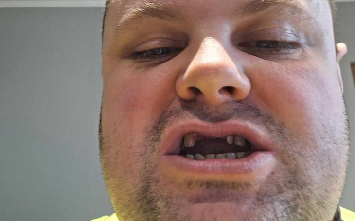 Zbiórka zęby dla przyjaciela - zdjęcie główne