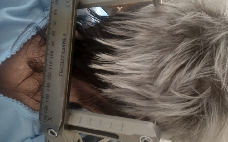 Zbiórka Zbieram na aparaty sluchowe - zdjęcie główne