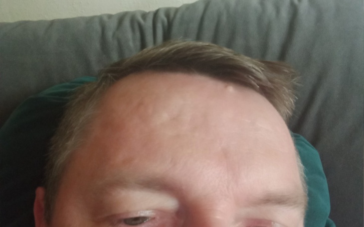 Zbiórka Ernest operacja - zdjęcie główne