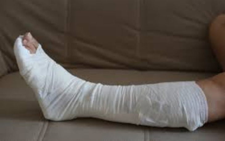 Zbiórka Operacja nogi po wypadku. - zdjęcie główne