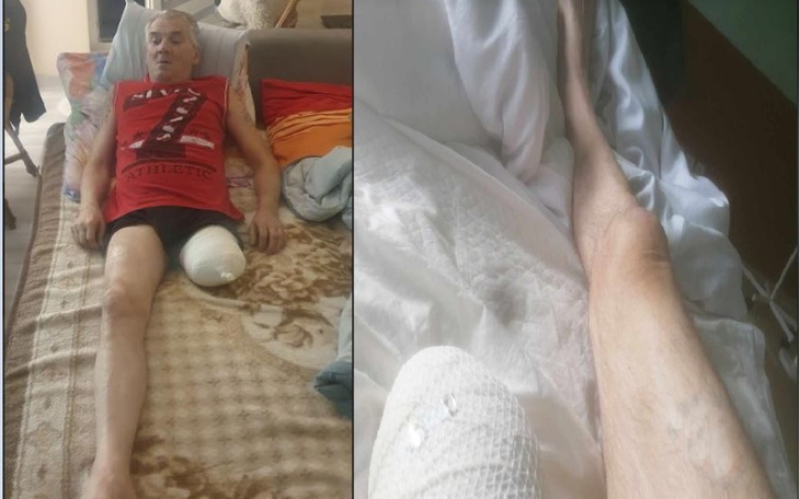 Zbiórka Na zakup protezy dla Taty - zdjęcie główne