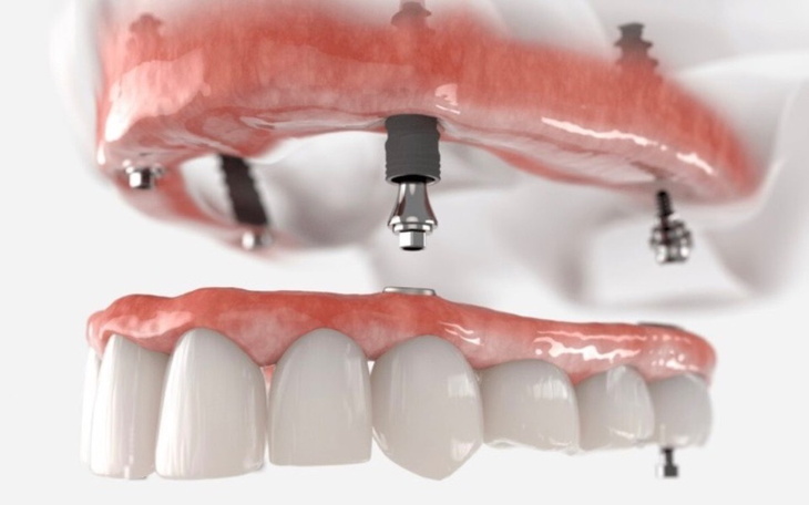 Zbiórka Nowy uśmiech i komfort życia - zdjęcie główne