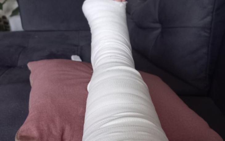 Zbiórka Leczenie nogi mojej mamy - zdjęcie główne