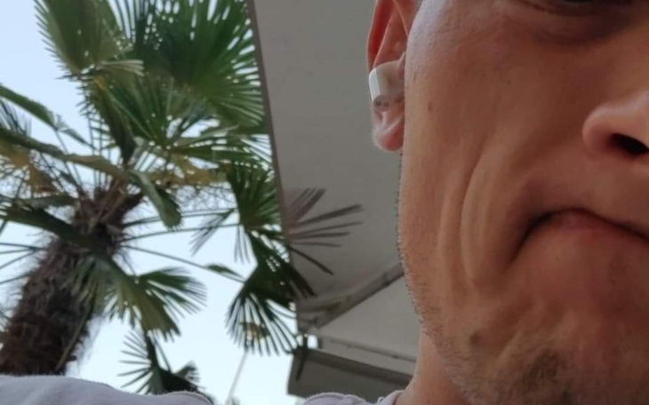 Zbiórka Zbieram na proteze zębów. - zdjęcie główne