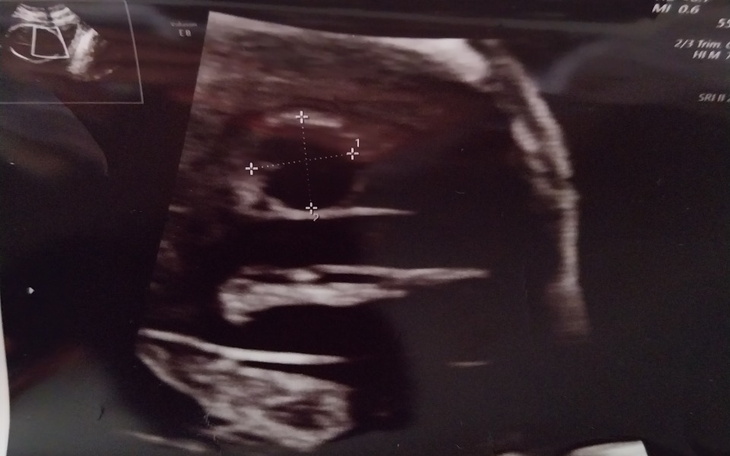 Zbiórka Długi, lekarzy oraz prawnika - zdjęcie główne