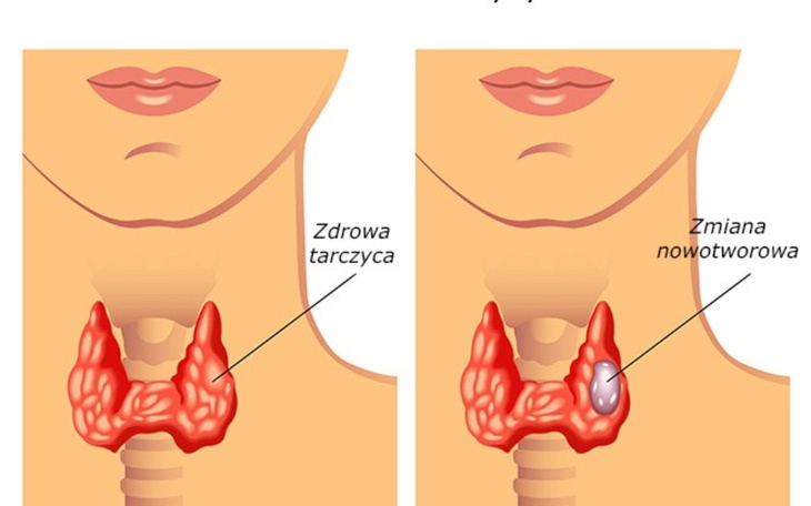 Zbiórka Pomoc wnuczce i chorej babci - zdjęcie główne