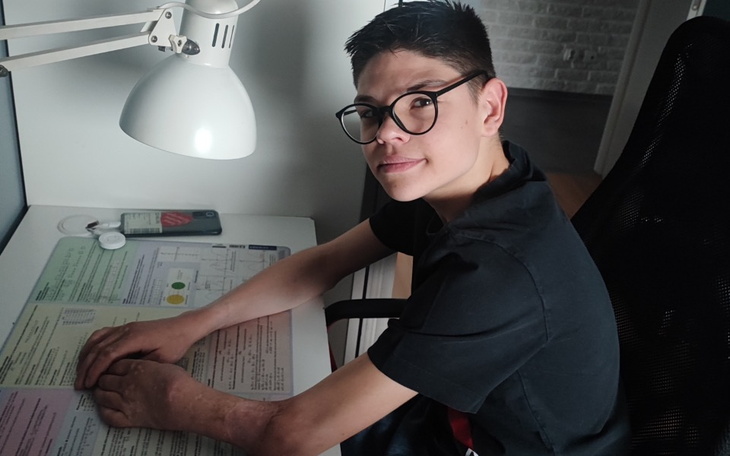 Zbiórka Wydłużenie ręki w 100 dni - zdjęcie główne