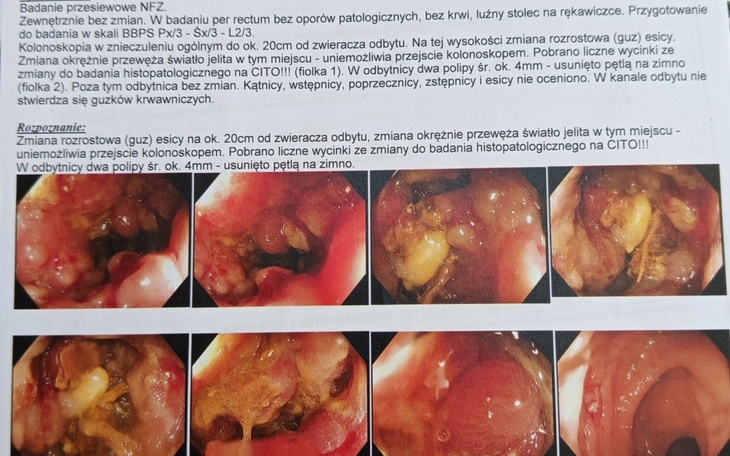 Zdjęcie medyczne przedstawiające wyniki badań.