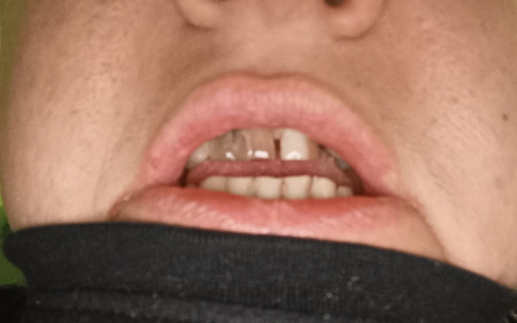 Zbiórka Pierwszy raz - zdjęcie główne