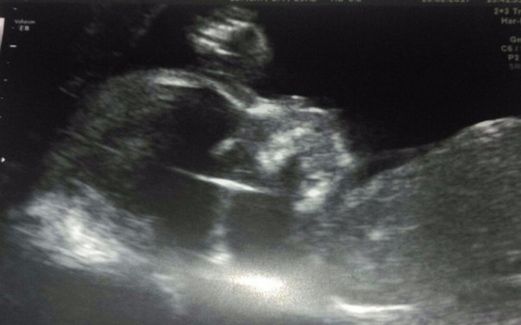 Zbiórka Zbiorka na wymarzony pokoj dla m - zdjęcie główne