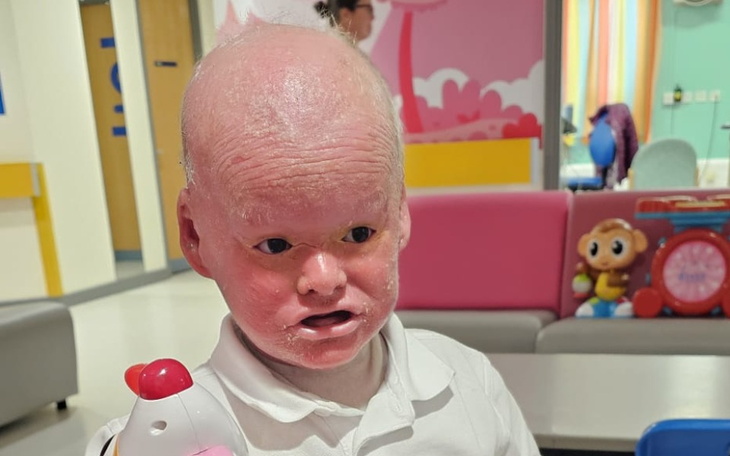 Zbiórka Wesprzyj wojownika Michała - zdjęcie główne