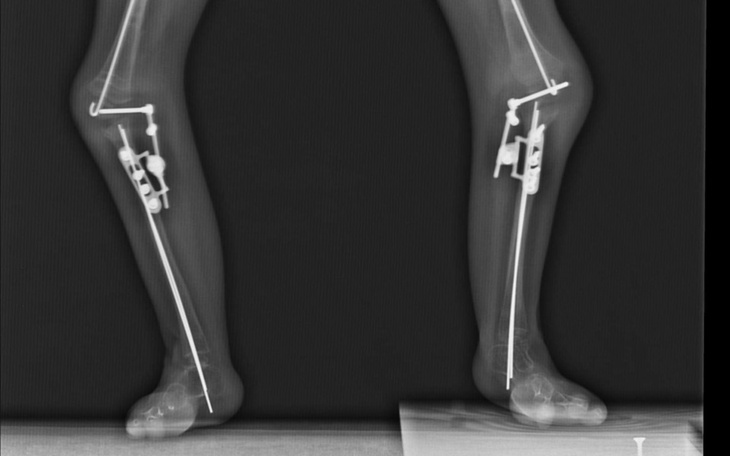 Zbiórka Mieć nogi do nieba - zdjęcie główne