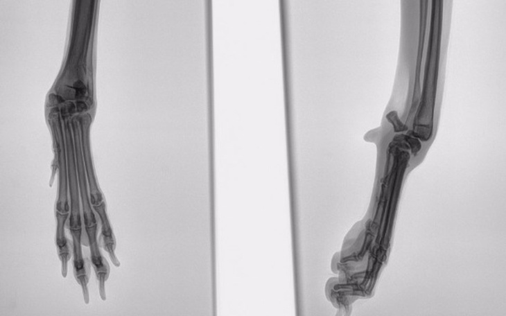 Zbiórka Suchy chce żyć bez bólu! - zdjęcie główne