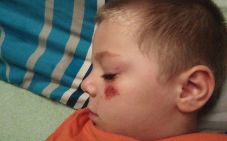 Zbiórka Dla Oskarka - zdjęcie główne