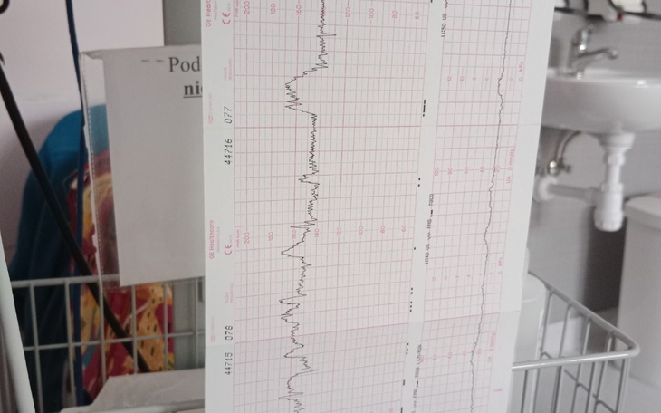 Zbiórka Na dziecko niemowlę - zdjęcie główne