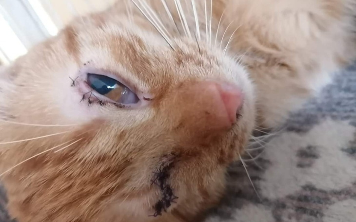 Zbiórka Bursztynek po usunięciu oka - zdjęcie główne