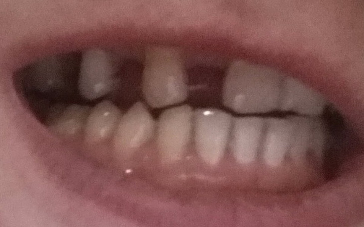 Zbiórka Wypadek/Dentysta - zdjęcie główne