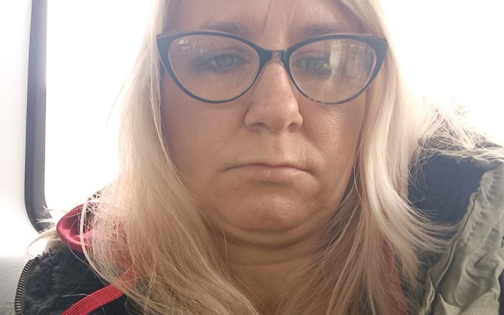 Zbiórka Dopłata do aparatu - zdjęcie główne