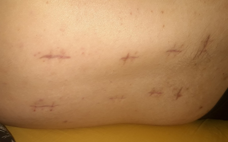 Zbiórka Zbiurka na nie refundowane leki - zdjęcie główne