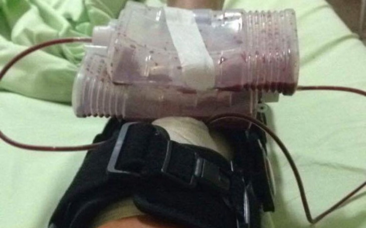 Zbiórka Pomoc dla piłkarza - zdjęcie główne