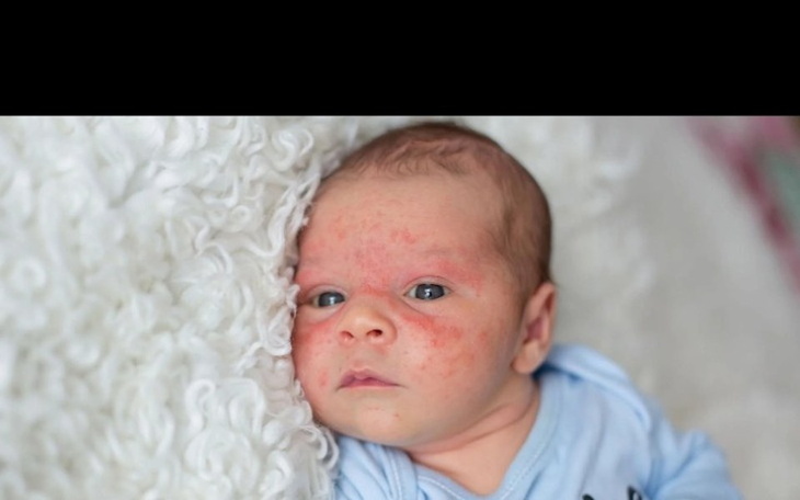 Zbiórka Pomóżmy Olafowi - zdjęcie główne