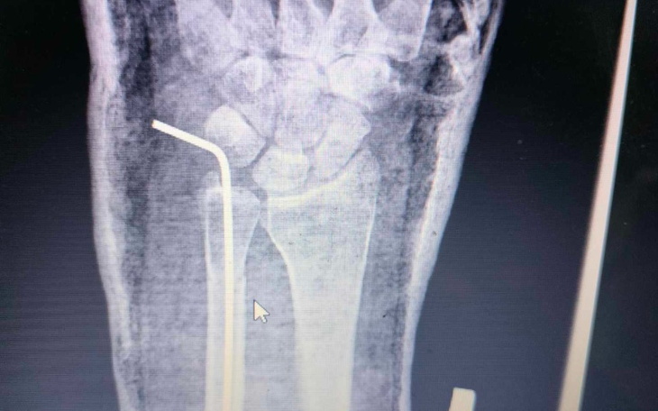 Zbiórka Przetrwać najtrudniejsze dni - zdjęcie główne