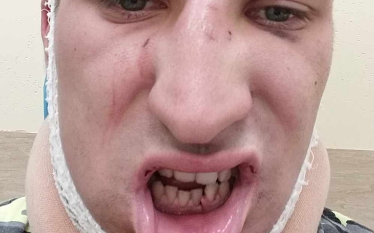 Zbiórka Leczenie Brata po pobiciu - zdjęcie główne