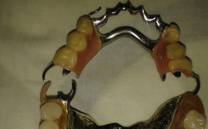 Zbiórka Nowy uśmiech i życie dla Joli - zdjęcie główne