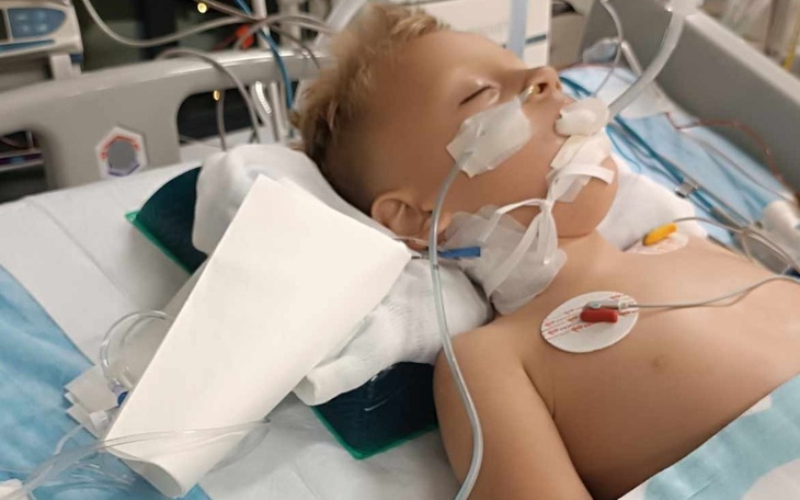 Dziecko na łóżku szpitalnym z podłączonymi urządzeniami medycznymi.