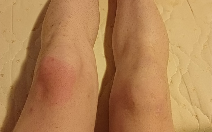 Zbiórka Zbieram na operacie Kolan - zdjęcie główne