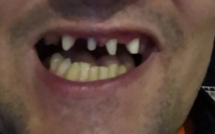 Zbiórka Zęby moje marzenie - zdjęcie główne