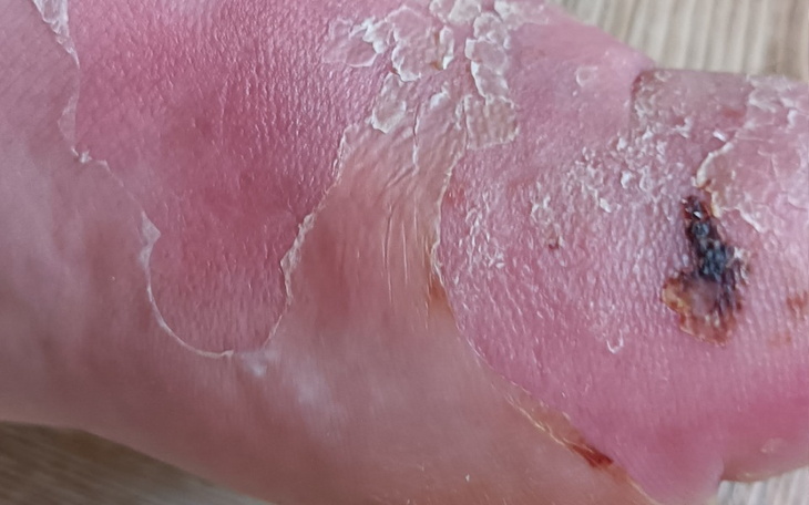 Zbiórka Zbieram Na Leczenie Pooperacyjne - zdjęcie główne