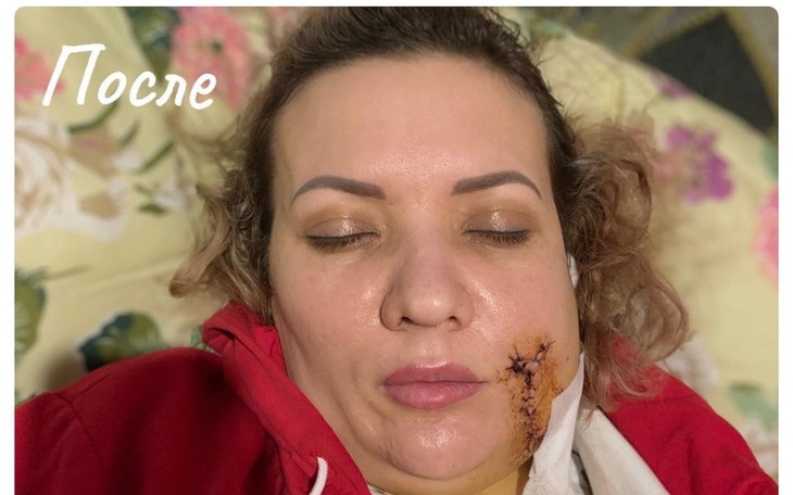 Zbiórka Help raise funds for surgery - zdjęcie główne