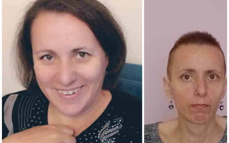 Zbiórka Pomóżmy Kasi wygrać z rakiem - zdjęcie główne