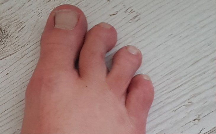 Zbiórka Niewidzialna ręka Reaktywacja - zdjęcie główne