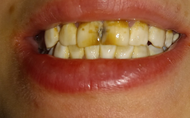 Zbiórka Zbieram na dentystę..... - zdjęcie główne