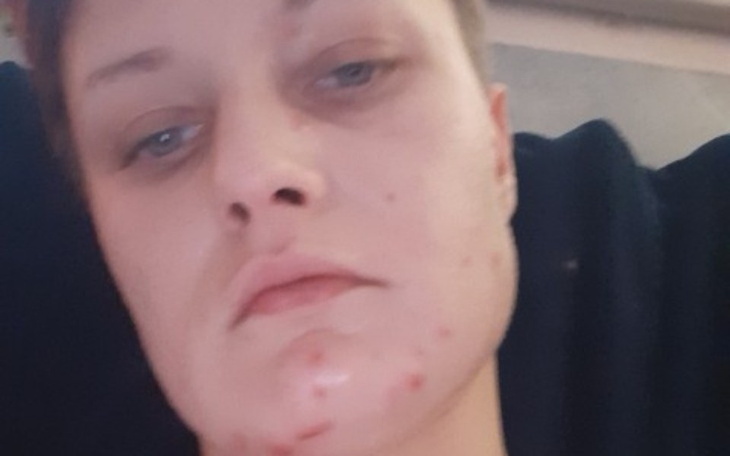 Zbiórka Na operację padaczki urazowej - zdjęcie główne