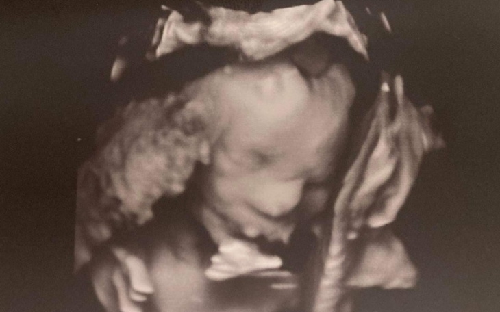 Zbiórka Dla mojego skarba - zdjęcie główne