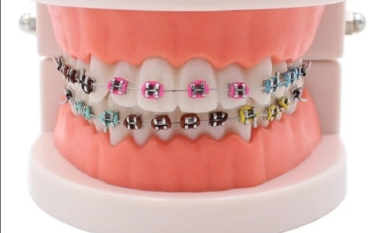 Zbiórka Zbiurka na aparat - zdjęcie główne