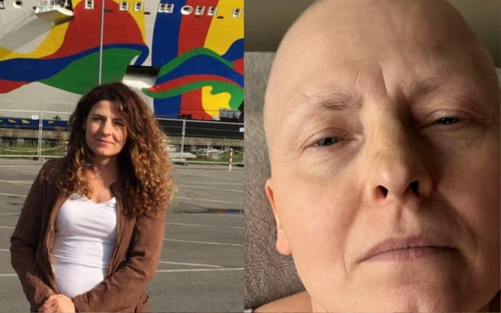 Kobieta przed kolorowym muralem, z blizną na głowie.