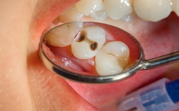 Zbiórka Leczenie dentystyczne. - zdjęcie główne