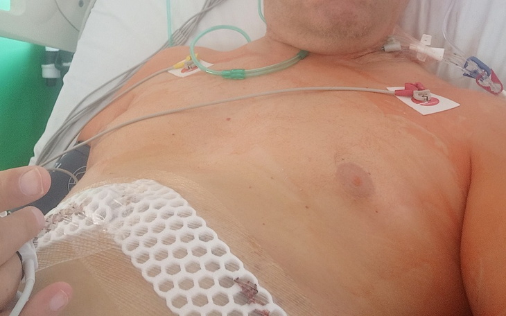 Zbiórka Zakup leków i rehabilitacje - zdjęcie główne