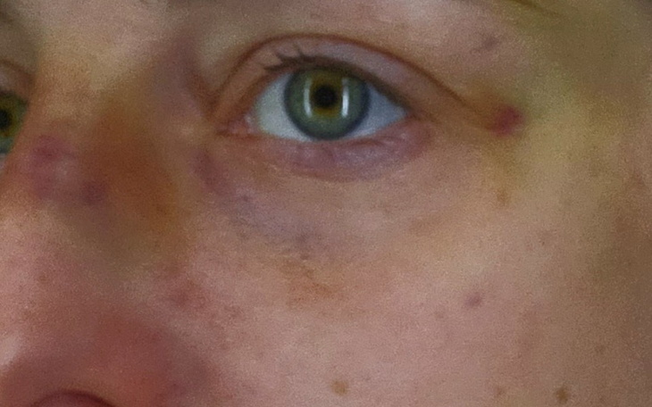 Zbiórka Wyjść z depresji i długów - zdjęcie główne