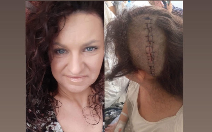 Zbiórka Pomoc dla mojej chorej mamy - zdjęcie główne