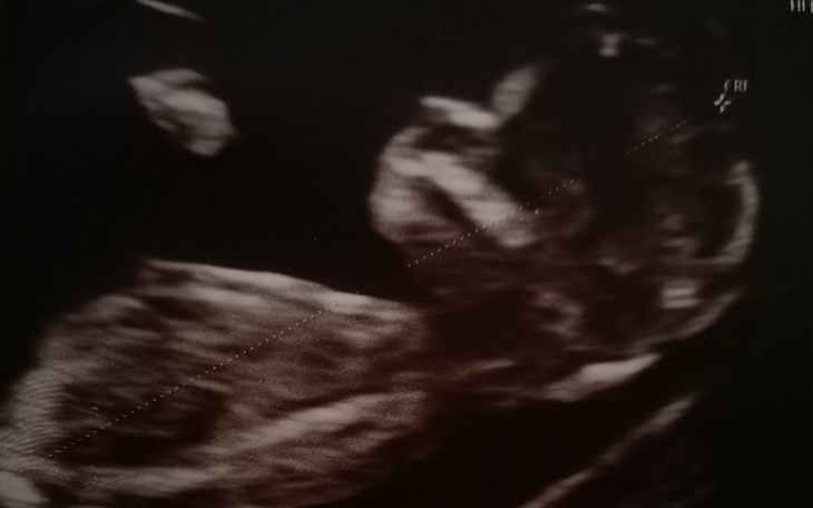 Zbiórka Walka o chore serduszko Wiki - zdjęcie główne